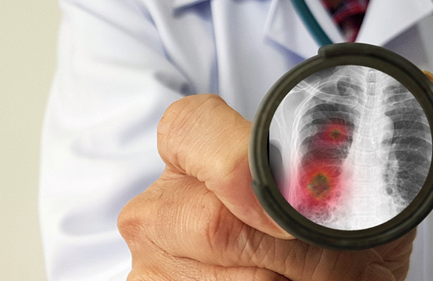 CORONA RUS HABER184334.805079.9612 ee225