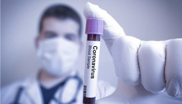 CORONA MOSKOVA 3 corona virus son durum ne korona virusu kac kisi oldu h1580803306 378fbc 828d0