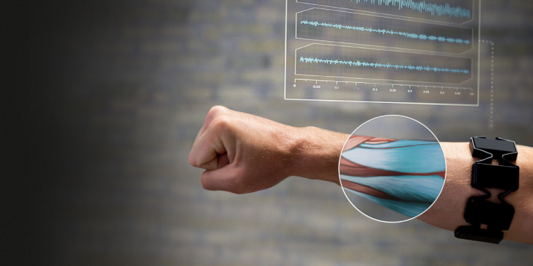 Myo Armband 750x375 0d889