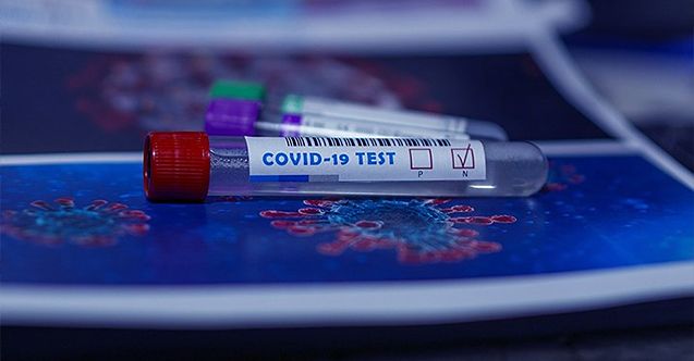 covid test 2 antalya da turistlerin testi otellerde yapilacak af445 8aa98