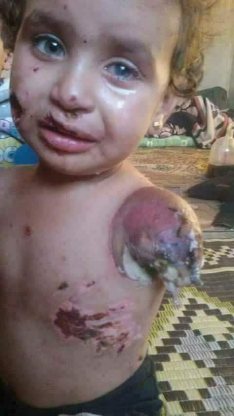 israil katliamı 1 f7005