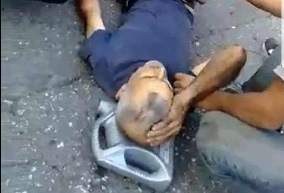 sanayide kaza yaralı 5 124775353 3459539587457390 1719813623620645355 n 8960a