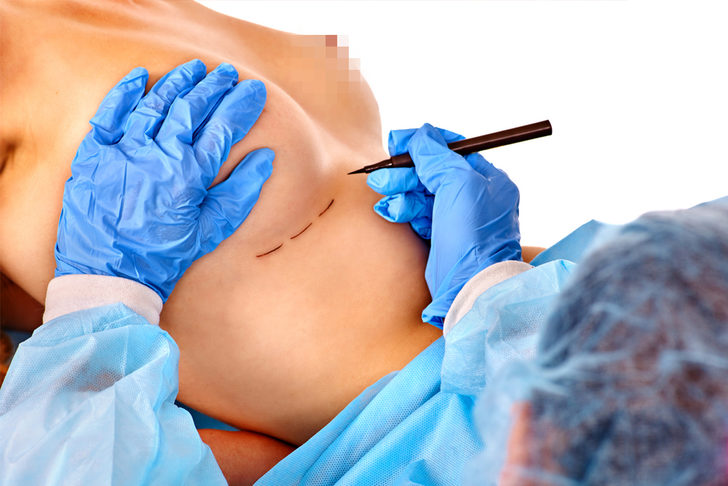 10518733 728xauto 27e34